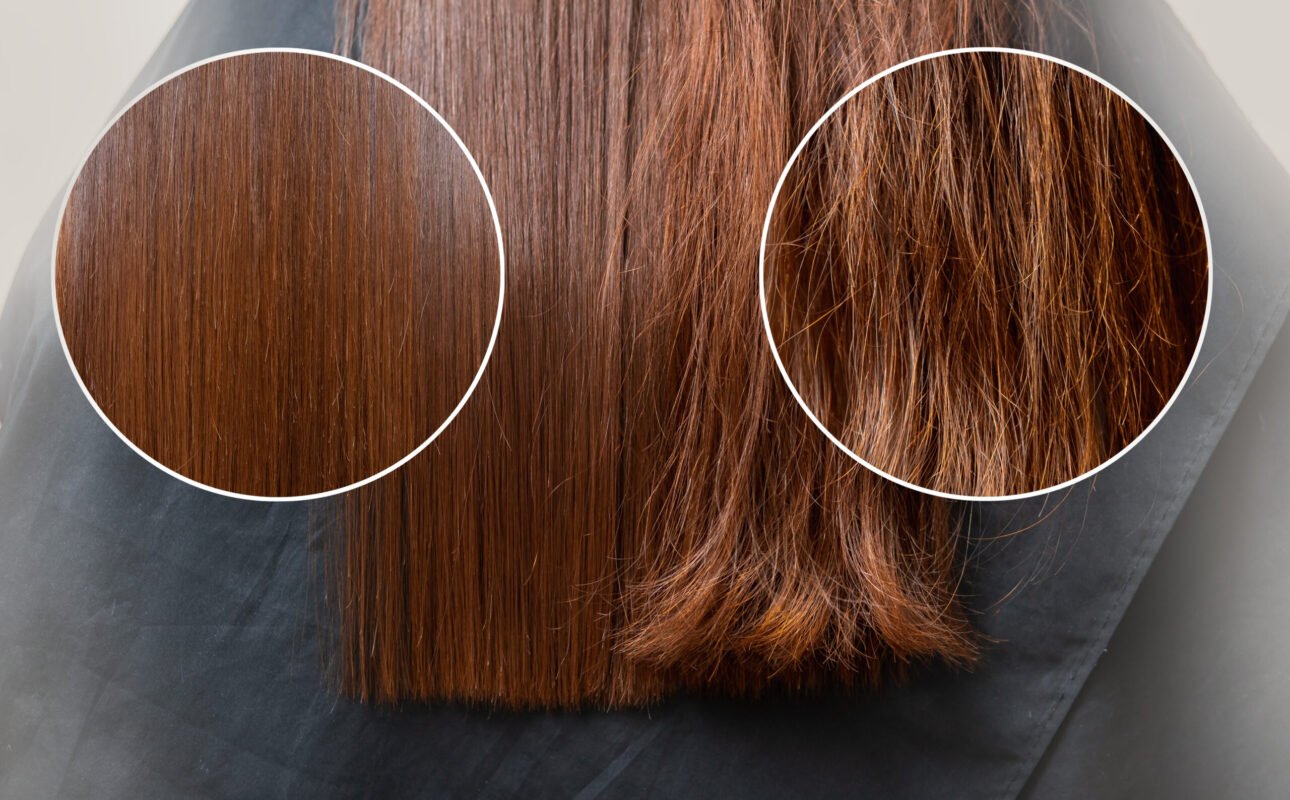 keratin vs nanoplastia